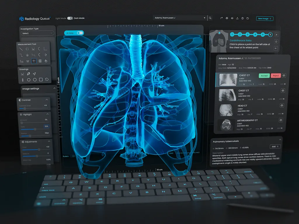 Chest X-ray Triage & Abnormality Tagging